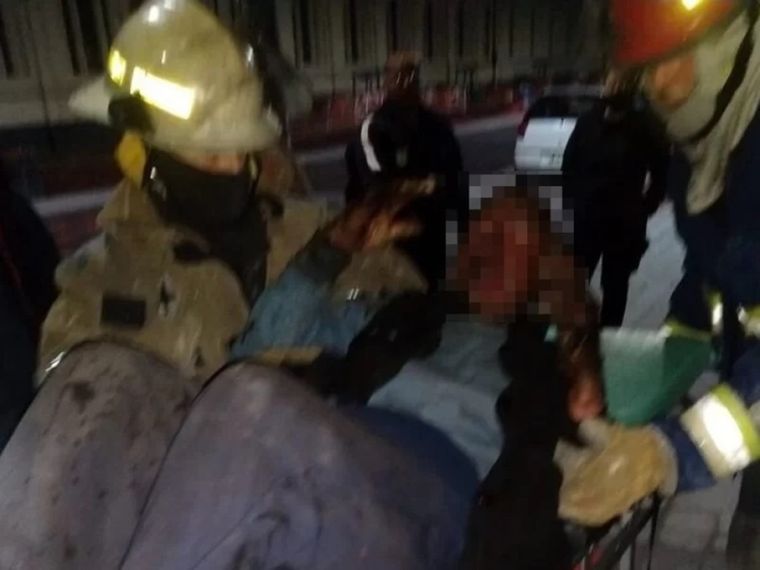 El hombre sufrió severas quemaduras Foto: Carolina Villalba