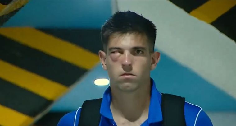 EL ojo de Altamirano tras el golpe. Foto: Captura