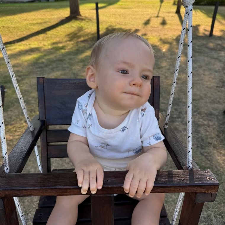 El diagnóstico médico confirmó una fractura de cráneo sin desplazamiento para el bebé. El diagnóstico médico confirmó una fractura de cráneo sin desplazamiento para el bebé.