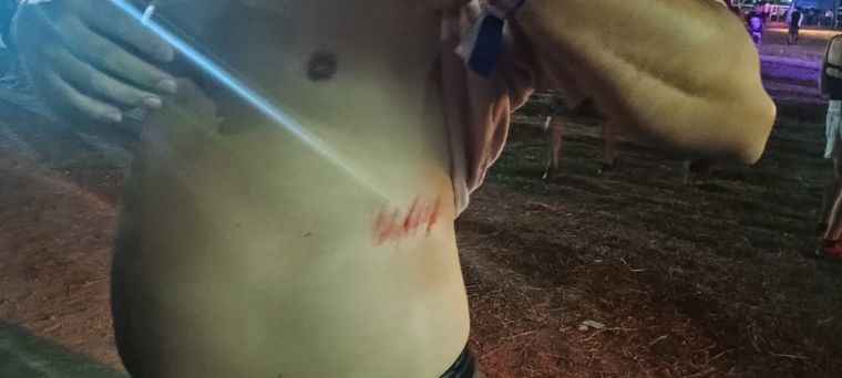 Uno de los asistentes a la Fiesta de la Cerveza terminó con lesiones tras caer al pozo.