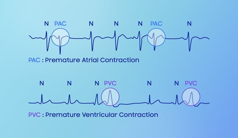El Galaxy Watch 8 mide la carga vascular mientras dormís y te ayuda a reducir riesgos cardiovasculares. El Galaxy Watch 8 mide la carga vascular mientras dormís y te ayuda a reducir riesgos cardiovasculares.