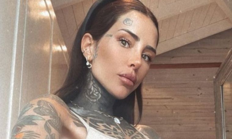 Candelaria Tinelli, mostró en sus redes el tratamiento que está realizando para removerse sus tatuajes.