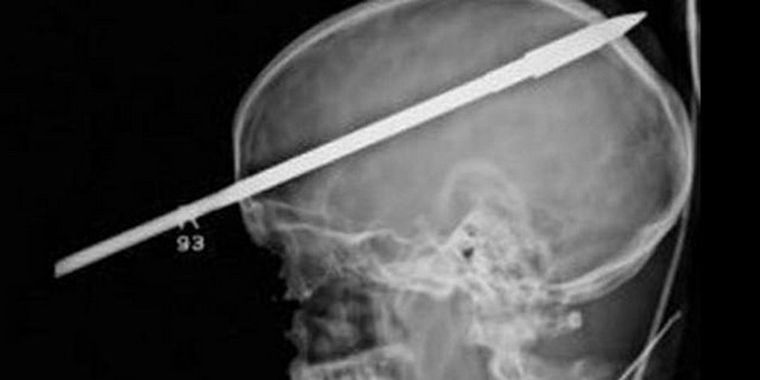 Impresionante radiografía.