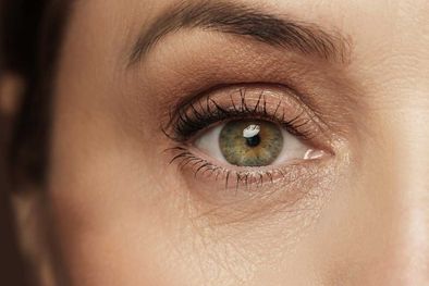 MDZol | Las ojeras son un problema para todos pero nosotras te traemos cinco soluciones que puedes usar en casa Foto: Semana