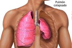 dia mundial contra el cancer de pulmon: lo que hay que saber