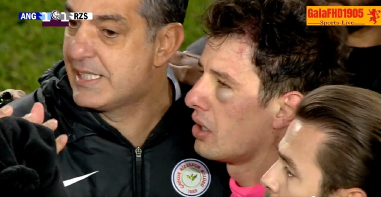 El árbitro sufrió una fuerte agresión.