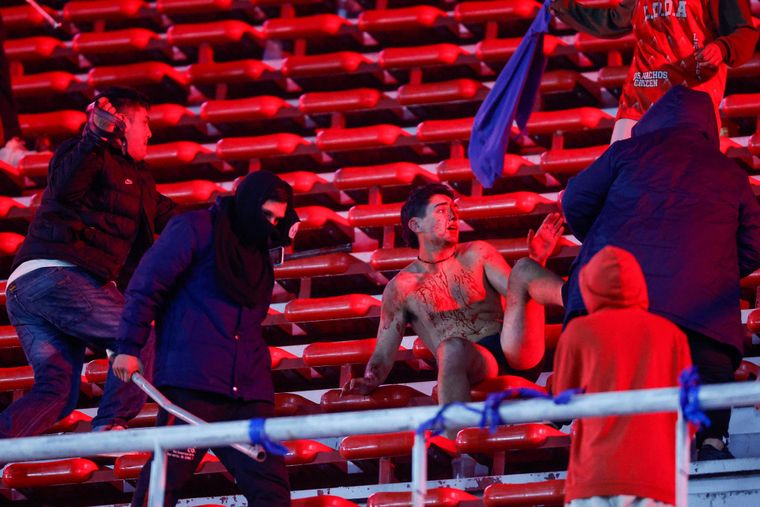 Un hincha chileno totalmente ensangrentado en la tribuna sur alta del Libertadores de América.