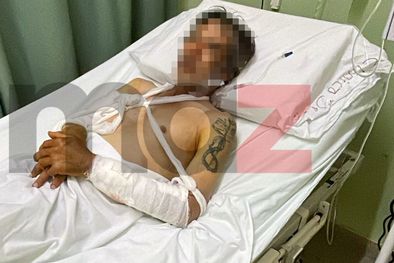 MDZol | Portada heridos perros pitbull