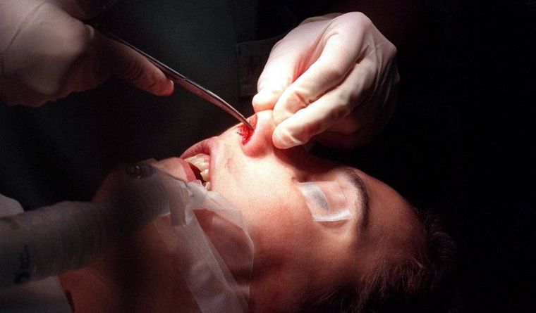 Las fosas nasales, previenen los médicos, son particularmente delicadas. (imagen ilustrativa) Foto: Efe.