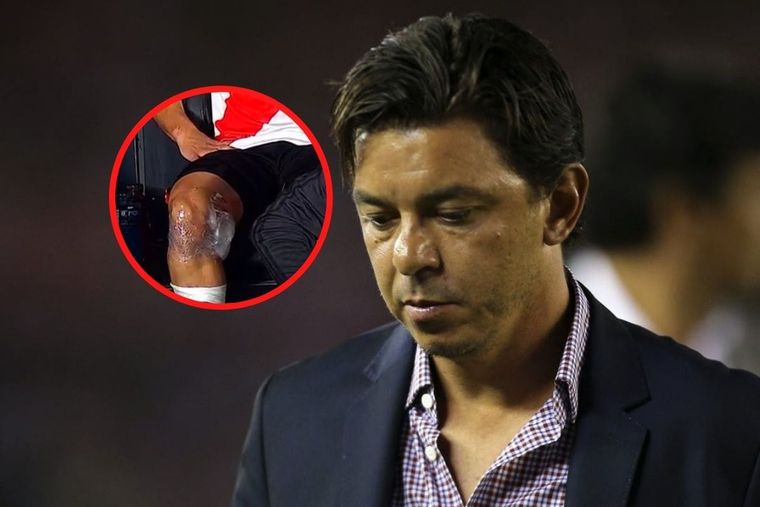 ¿Preocupación en River de cara al Superclásico?