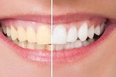 Con este truco casero en una semana se notarán los cambios Foto: Archivo