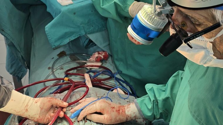 Claudio Burgos en pleno trasplante. Claudio Burgos en pleno trasplante.