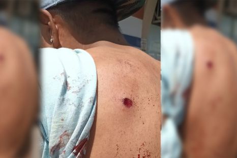Uno de los heridos, con sangre en la espalda Foto: NA