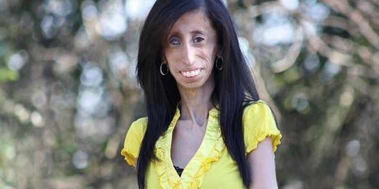 Lizzie Velásquez debe comer cada 15 minutos. Foto: LOVELSHIS.COM