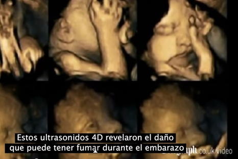 Esto es lo que pasa con un bebé en el vientre cuando su madre fuma