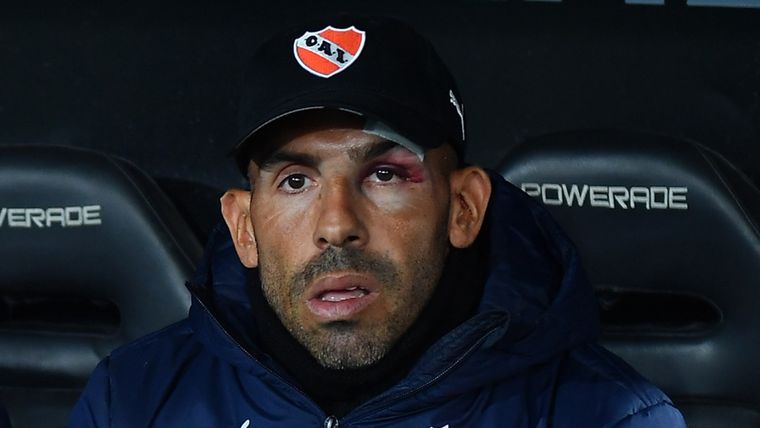 El DT deberá meter mano en el equipo titular. Foto: Télam