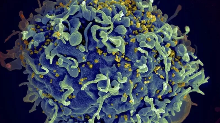 Esta electromicrografía muestra al virus VIH infectando una célula humana. La variante VB generó una mayor carga viral en pacientes que aún no reciben tratamiento Foto: GETTY IMAGES