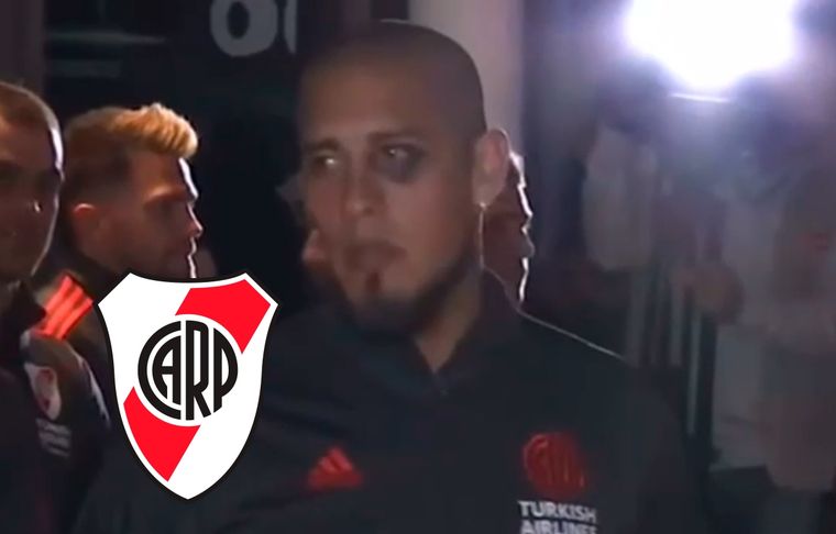 Jonatan Maidana El defensor apareció en Santa Fe con el ojo morado.