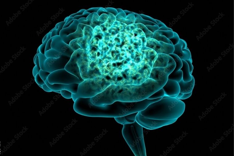 Test Visual Test Visual y cerebro Foto: Adobe Stock