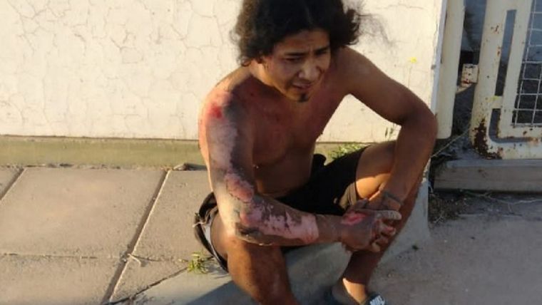 El individuo después del accidente Foto: Gentileza Mejor Informado (Neuquén)