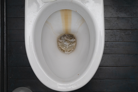 El sarro puede ser el mayor enemigo de la limpieza del baño. Foto: Archivo El sarro puede ser el mayor enemigo de la limpieza del baño. Foto: Archivo