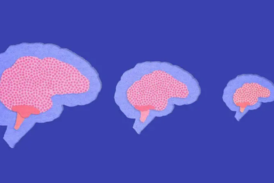 MDZol | GETTY IMAGES/BBC Foto: GETTY IMAGES/BBC