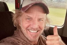 Facundo Arana tiene carcinoma, un cáncer de piel El actor emocionó con un posteo buscando concientizar sobre la prevención Foto: @facundoaranatagle