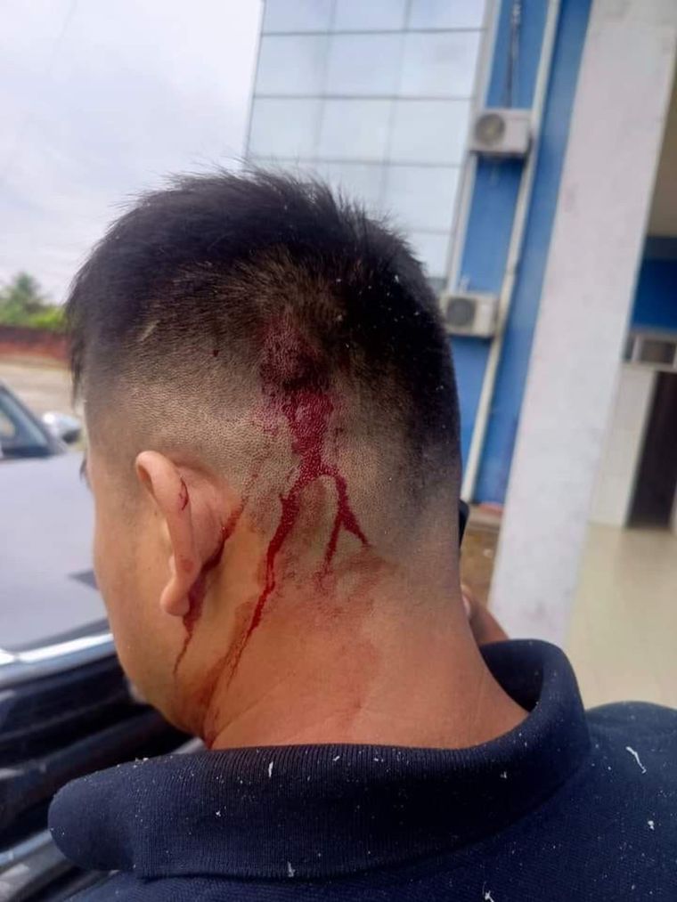 El chofer de Evo Morales terminó con heridas en su cabeza y uno de sus brazos. Foto: EFE