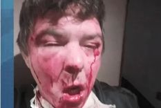 El rostro del portero tras el salvaje ataque del violento vecino del edificio de San Cristóbal