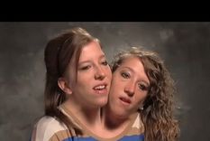 Las hermanas Hensel no logran salir del ojo público. Créditos: Instagram / abbyandbrittany