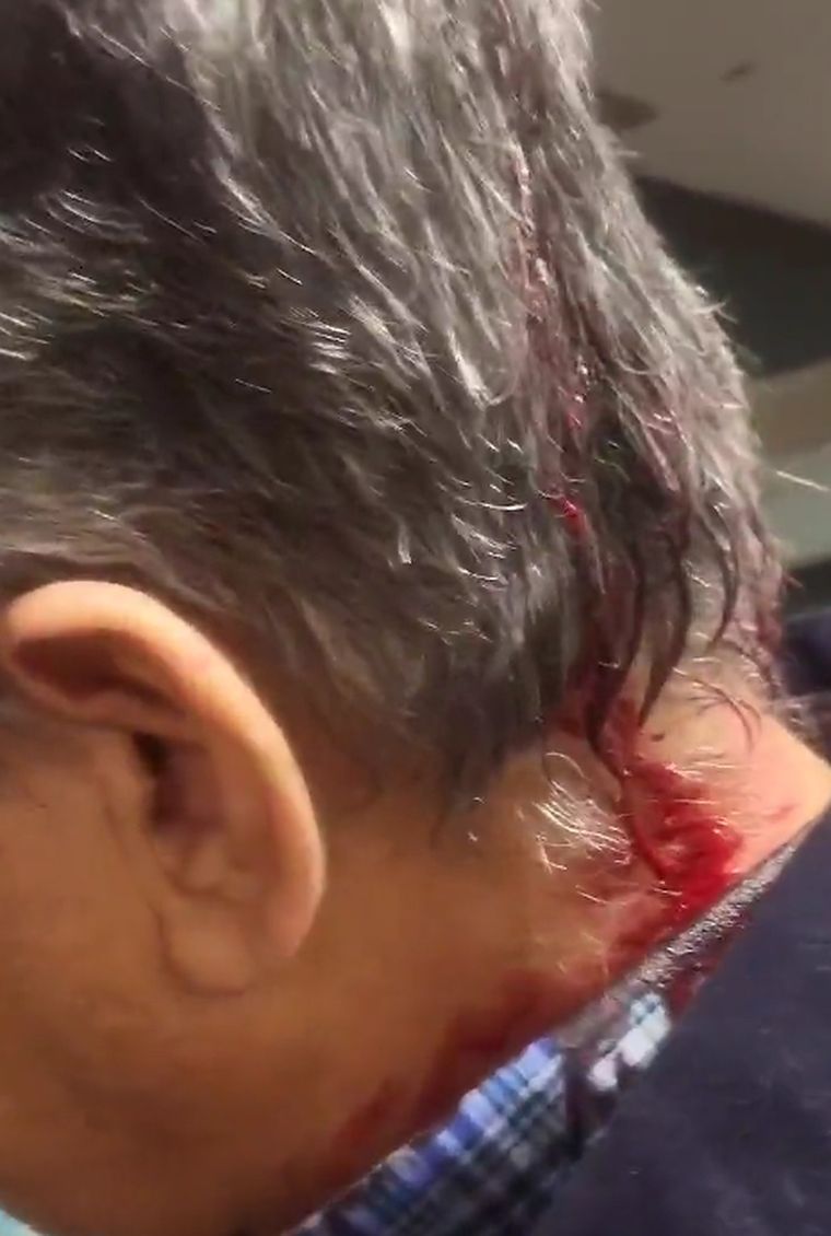 Un militante de LLA sufrió una violenta agresión en Constitución Foto: Captura de pantalla