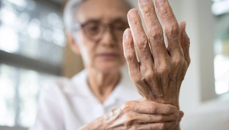 El primer síntoma de la artritis reumatoide se manifiesta en las manos. Foto: MDZ