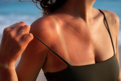 MDZol | El protector solar es fundamental para cuidarse de las quemaduras Foto: Freepik