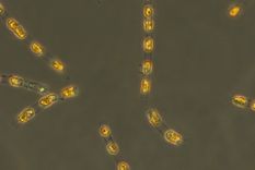 Completamente activa de nuevo, incluso después de unos 7.000 años sin luz ni oxígeno, en los sedimentos del mar Báltico: la diatomea Skeletonema marinoi. Foto: Dpa.