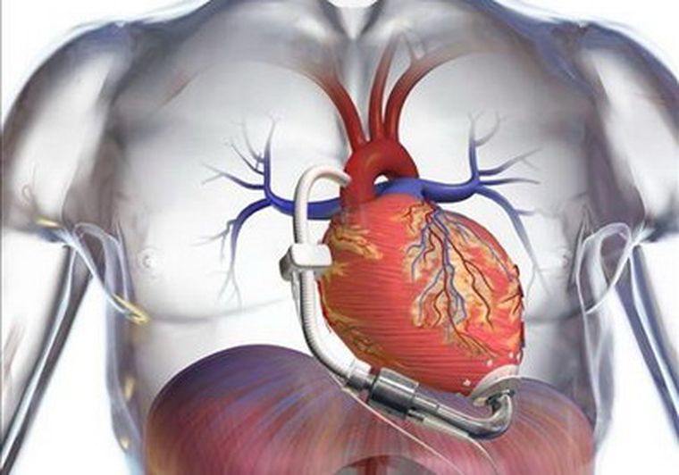 Nuevas opciones para quienes tienen problemas cardiacos. (Foto ilustrativa de archivo) Foto: epa