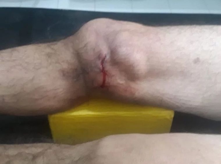 El hombre sufrió un fuerte golpe en un dique de San Juan y tuvo que ser asistido