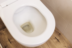 Adiós a las desagradables manchas en el fondo del inodoro. Foto: Shutterstock