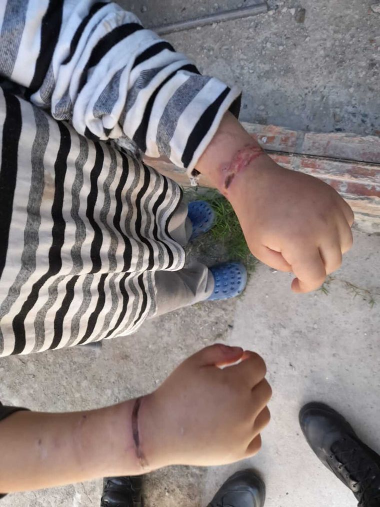 Las lesiones del pequeño fueron provocadas por su madre