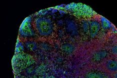 La foto de arriba revela la estructura de un organoide cerebral fabricado en Río de Janeiro. Los puntos rojos son neuronas y los puntos azules indican el núcleo celular. Las manchas verdes son progenitores neuronales, estructuras que dan lugar a células en el sistema nervioso.