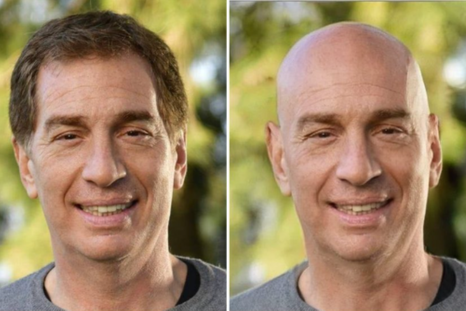 Así se vería Santilli sin pelo, según una imagen creada por la militancia libertaria. Así se vería Santilli sin pelo, según una imagen creada por la militancia libertaria.