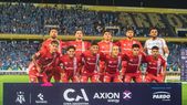 Atento, Boca: la pésima noticia que preocupa a Argentinos Juniors a horas del choque en la Bombonera