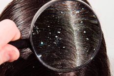 Un problema que puede tener origen emocional . Foto: SHUTTERSTOCK