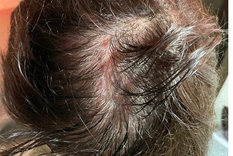 lo atacaron de atras en su propio jardin: no es joda la cosa lo atacaron de atras en su propio jardin: no es joda la cosa