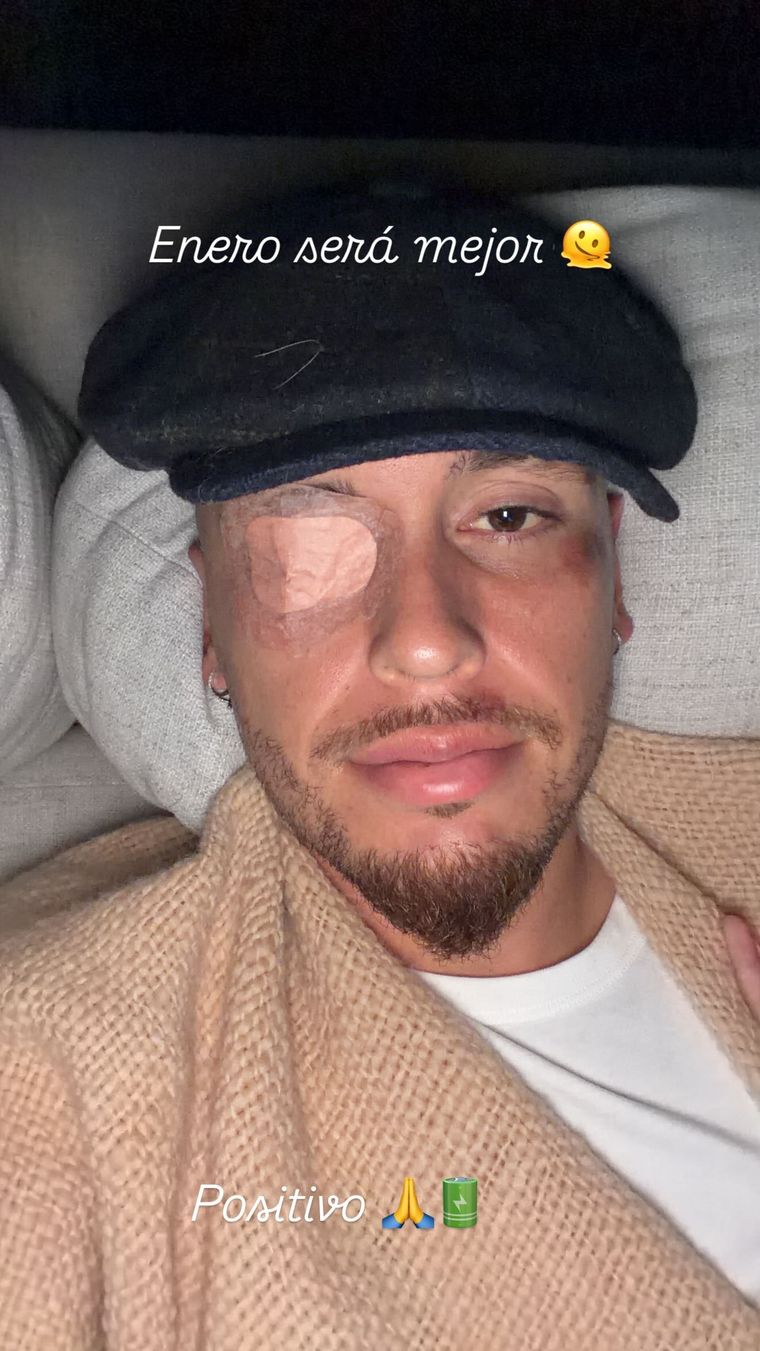 Lucas Ocampos, afectado por una parálisis facial tras su lesión.