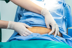 La resección de piel excedente, pero como un último paso dentro de una estrategia integral y no como el procedimiento principal.