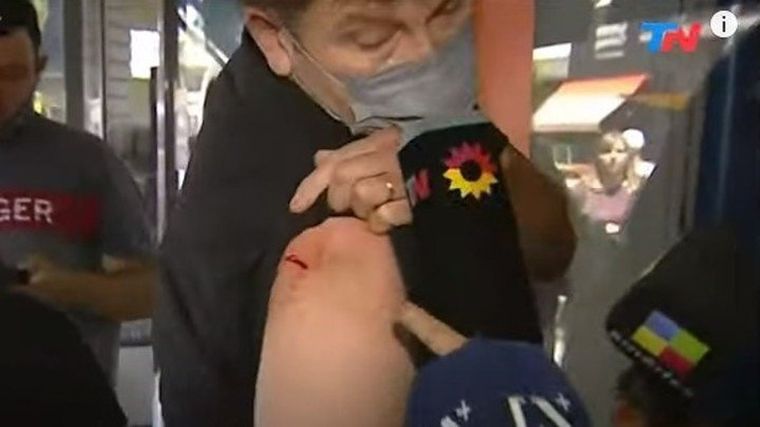 Un hombre fue apuñalado para robarle el celular en la localidad bonaerense de Ramos Mejía.