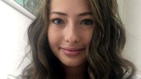 Anna Byard-Golds tomó conciencia de que tenía un problema en la piel cuando tenía 4 o 5 años de edad. Foto: BBC