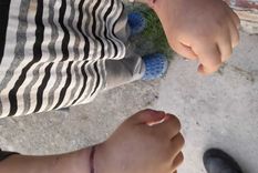 Las muñecas del pequeño tiene severas lesiones