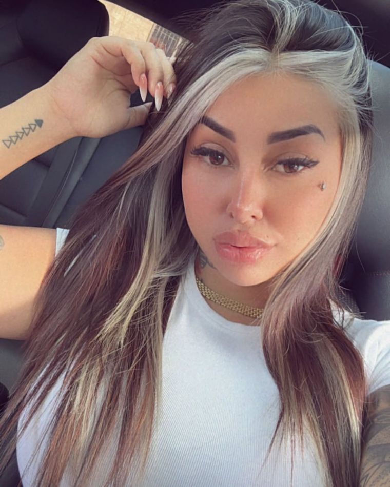 La influencer ya había hablado de este problema. Foto: Instagram @tamibaez222.