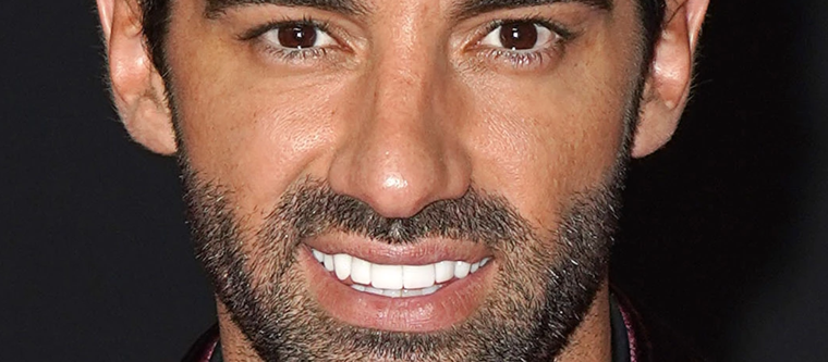 Toni Costa dejó la mansión que compartía con Adamari Lopez cuando se separaron. Foto: Telemundo - https://media.telemundo40.com/2021/05/tlmd-toni-costa-video-1.jpg